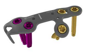 Lapidus Hook Plate