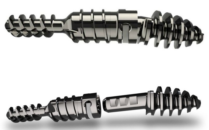 Nextra Hammertoe Correction System Rescue Implant