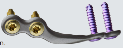 Plantar Python 2 Anatomic Tension Side Plate