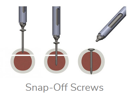 Tyber Snap-Off Screw
