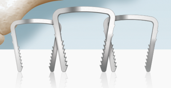 Neospan® Staple