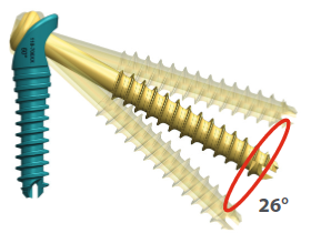 Io Fix Lag Screw Polyaxial