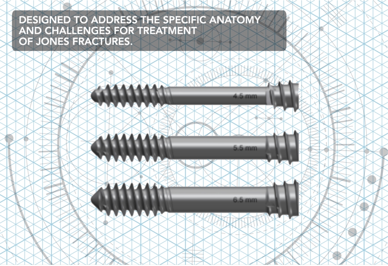 Jones Screw 5th Metatarsal Screw