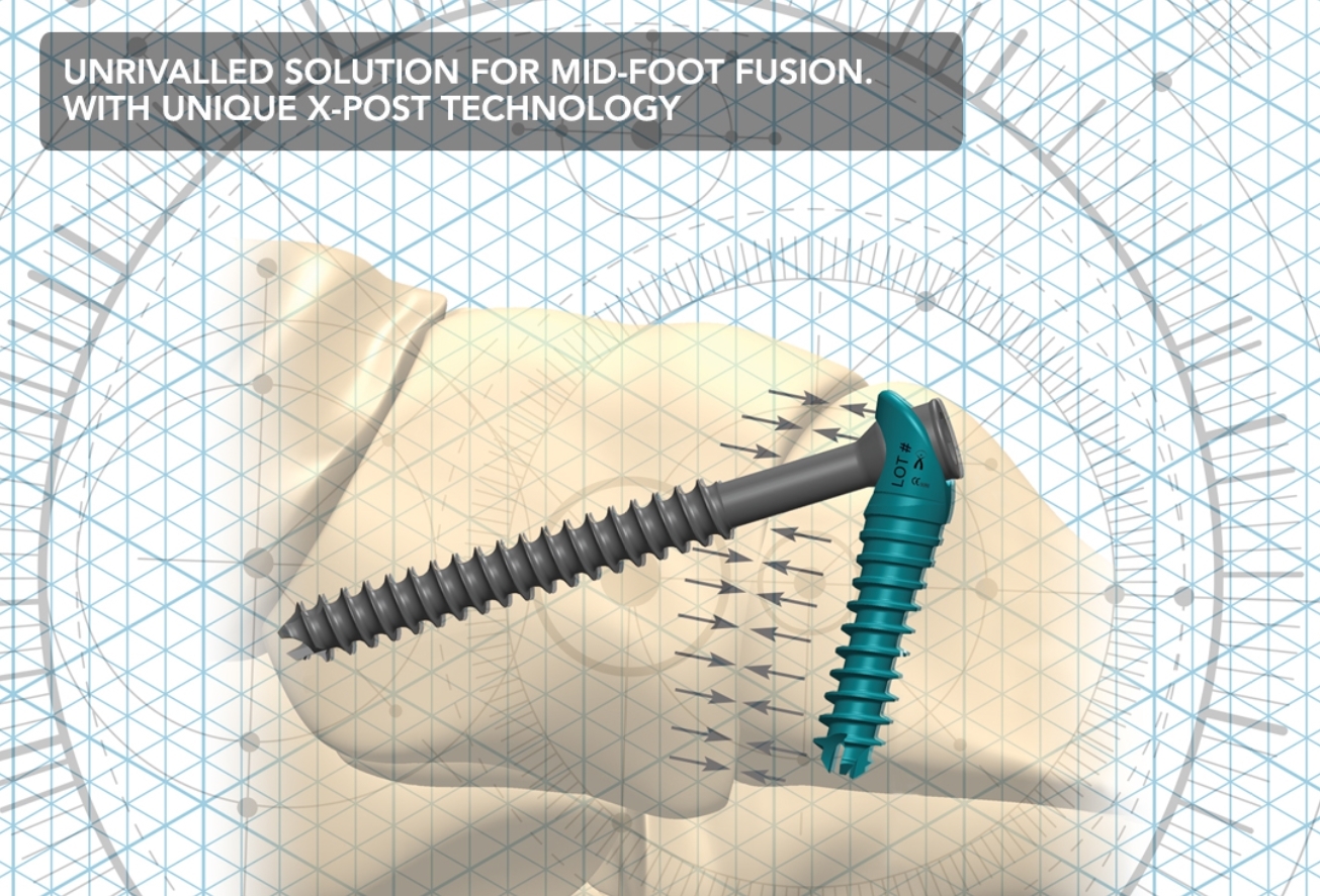 Io Fix Lag Screw Polyaxial