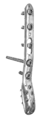 ANTHEM Lateral Distal Fibula Plate