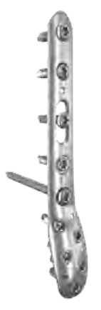 ANTHEM Universal Distal Fibula Plate