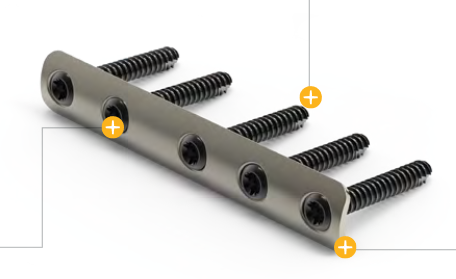 One-Third Tubular Plate