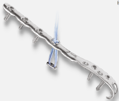 Arthrex Hook Locking Lateral Plate