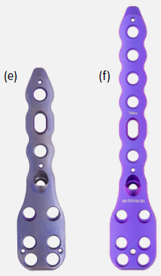 Arthrex Ankle Lateral Tibio-Talar Fusion Plate