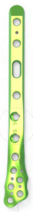 Fibula Lateral Plate