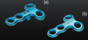 Arthrex Proximal Open Wedge Plate