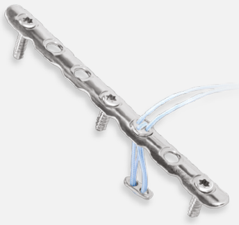 Arthrex Third Tubular Locking Plate