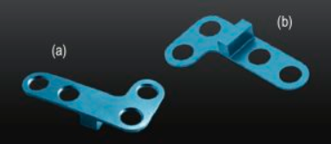 Arthrex LPS Opening Wedge Plate