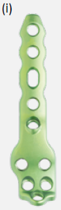 Arthrex Ankle Posterior Tibio-Talo-Calcaneal Fusion Plate