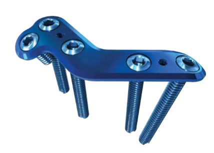 Calcaneal Ant Process Plate