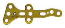 Medial Column Plate