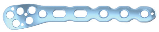 ARIX Ankle System Bone Plate