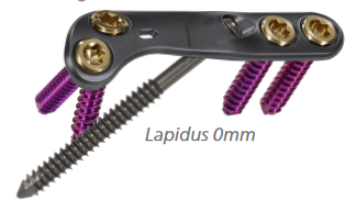 Ortholoc 3Di Crosscheck Lapidus plate