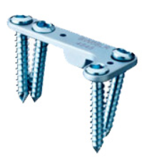 Wedge Plate