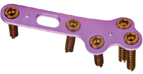 AVID MTP Plate