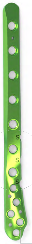Fibula Postero-Lateral Plate