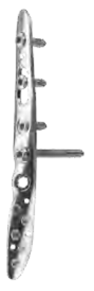 ANTHEM Postero-Lateral Distal Fibula Plate