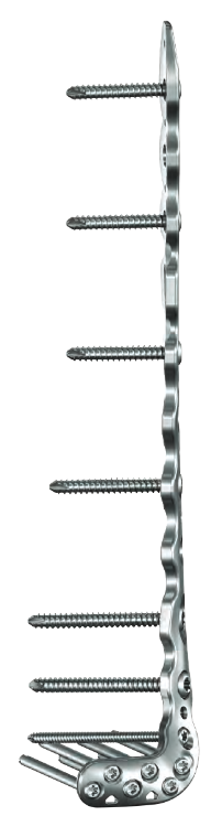 ANTHEM Antero-Lateral Distal Tibia Plate