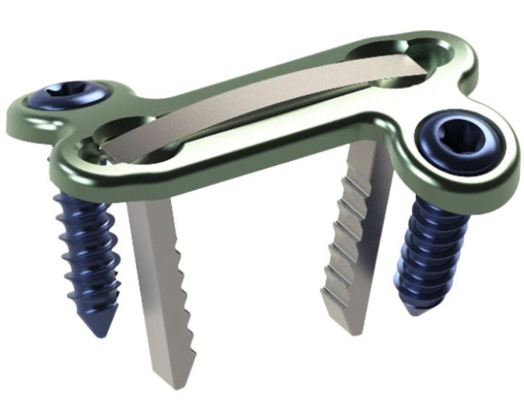 Dynaforce Z beta plate