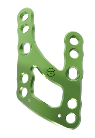 Medial Lisfranc Arthrodesis Plate