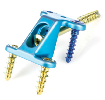 Ultos Calcaneal Step Plate