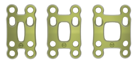 Dorsal Lisfranc Arthrodesis Plate