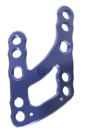 Medial Lisfranc Arthrodesis Plate